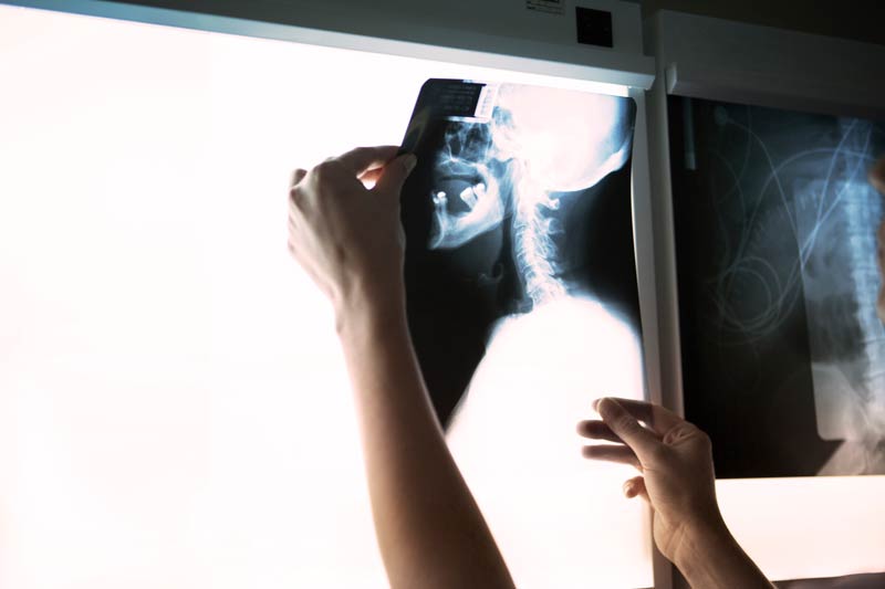 woman examining neck x-ray